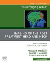 Imaging of the Post Treatment Head and Neck, An Issue of Neuroimaging Clinics of North America, E-Book (Clinics Collections) 2021 Original PDF