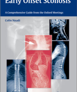 Early Onset Scoliosis: A Comprehensive Guide from the Oxford Meetings