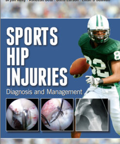Sports Hip Injuries: Diagnosis and Management 1st Edition