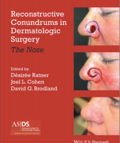 Reconstructive Conundrums in Dermatologic Surgery: The Nose 1st Edition