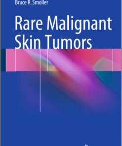 Rare Malignant Skin Tumors 2015th Edition