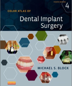 Ebook Color Atlas of Dental Implant Surgery 4th Edition