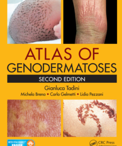 Atlas of Genodermatoses, Second Edition