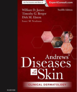 Andrews' Diseases of the Skin: Clinical Dermatology, 12e
