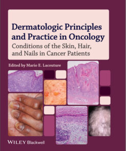 Dermatologic Principles and Practice in Oncology: Conditions of the Skin, Hair, and Nails in Cancer Patients 1st Edition