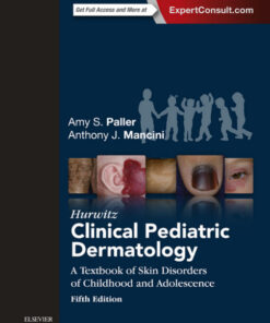 Hurwitz Clinical Pediatric Dermatology: A Textbook of Skin Disorders of Childhood and Adolescence  5th Edition