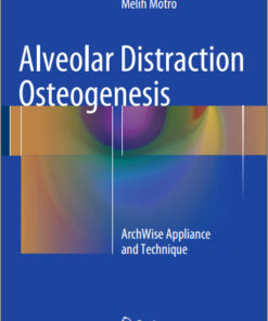 Ebook Alveolar Distraction Osteogenesis: ArchWise Appliance and Technique 2015th Edition