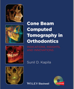 Ebook Cone Beam Computed Tomography in Orthodontics: Indications, Insights, and Innovations 1st Edition