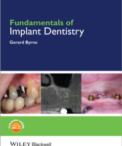 Ebook  Fundamentals of Implant Dentistry 1st Edition