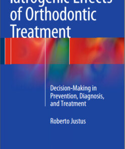 Ebook Iatrogenic Effects of Orthodontic Treatment: Decision-Making in Prevention, Diagnosis, and Treatment 2015th Edition