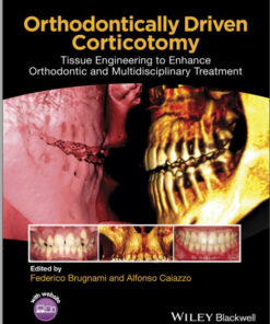 Ebook  Orthodontically Driven Corticotomy: Tissue Engineering to Enhance Orthodontic and Multidisciplinary Treatment 1st Edition