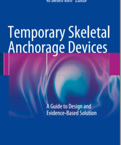 Ebook  Temporary Skeletal Anchorage Devices: A Guide to Design and Evidence-Based Solution