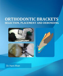 Ebook  Orthodontic Brackets: Selection,Placement and Debonding 1st Edition