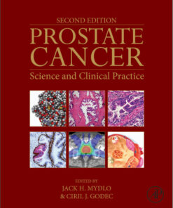 Prostate Cancer, Second Edition: Science and Clinical Practice 2nd Edition