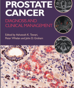 Prostate Cancer: Diagnosis and Clinical Management 1st Edition