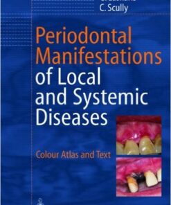 Ebook  Periodontal Manifestations of Local and Systemic Diseases: Colour Atlas and Text