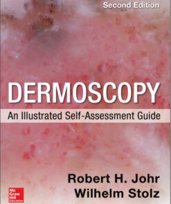 Dermoscopy: An Illustrated Self-Assessment Guide 2nd Edition