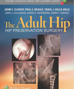 The Adult Hip: Hip Preservation Surgery 3e
