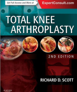 Total Knee Arthroplasty  2nd Edition