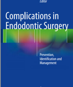 Ebook Complications in Endodontic Surgery: Prevention, Identification and Management