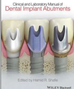Ebook Clinical and Laboratory Manual of Dental Implant Abutments 1st Edition