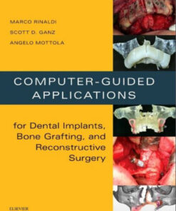 Ebook Computer-Guided Applications for Dental Implants, Bone Grafting, and Reconstructive Surgery (adapted translation), 1e
