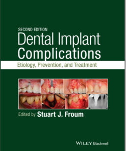 Ebook Dental Implant Complications: Etiology, Prevention, and Treatment 2nd Edition