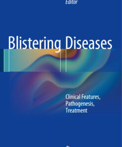Blistering Diseases: Clinical Features, Pathogenesis, Treatment 2015th Edition