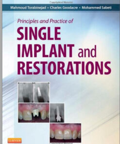 Ebook Principles and Practice of Single Implant and Restoration, 1e 1st Edition