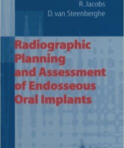 Ebook Radiographic Planning and Assessment of Endosseous Oral Implants
