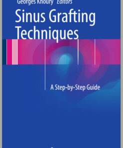 Ebook  Sinus Grafting Techniques: A Step-by-Step Guide 2015th Edition