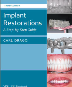 Ebook Implant Restorations: A Step-by-Step Guide 3rd Edition