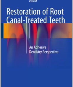 Restoration of Root Canal-Treated Teeth: An Adhesive Dentistry Perspective 1st ed. 2016 Edition