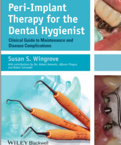 Peri-Implant Therapy for the Dental Hygienist: Clinical Guide to Maintenance and Disease Complications 1st Edition