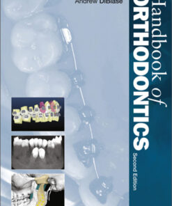Handbook of Orthodontics, 2e
