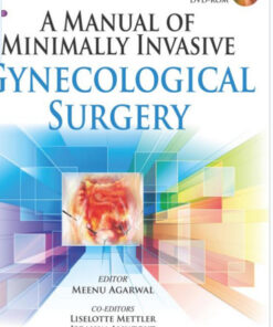 A Manual of Minimally Invasive Gynecological Surgery 1st Edition