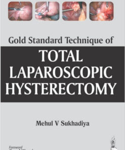 Gold Standard Technique of Total Laparoscopic Hysterectomy 1st Edition