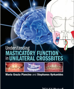 Understanding Masticatory Function in Unilateral Crossbites 1st Edition