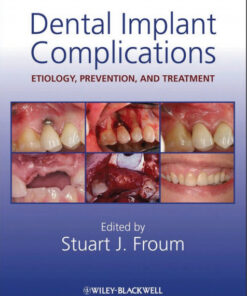 Dental Implant Complications: Etiology, Prevention, and Treatment 1st Edition