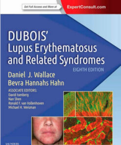 Dubois' Lupus Erythematosus and Related Syndromes: Expert Consult - Online and Print, 8e 8th Edition