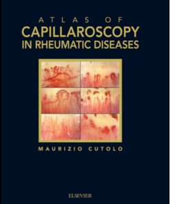 Atlas of Capillaroscopy In Rheumatic Diseases