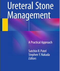 Ureteral Stone Management: A Practical Approach 2015th Edition