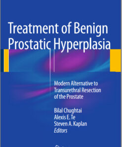 Treatment of Benign Prostatic Hyperplasia: Modern Alternative to Transurethral Resection of the Prostate 2015th Edition