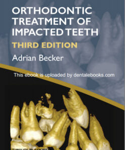 Orthodontic Treatment of Impacted Teeth 3rd Edition
