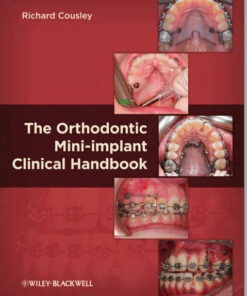 The Orthodontic Mini-implant Clinical Handbook 1st Edition