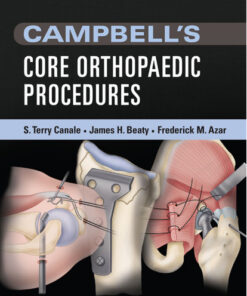 Campbell's Core Orthopaedic Procedures, 1e