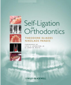 Self-Ligation in Orthodontics 1st Edition