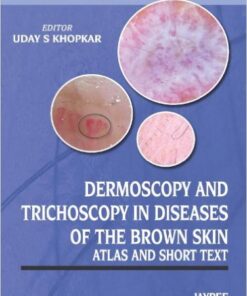 Dermoscopy and Trichoscopy in Diseases of the Brown Skin: Atlas and Short Text 1st Edition