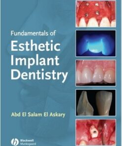 Fundamentals of Esthetic Dentistry, Second Edition