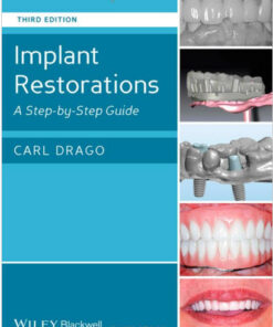 Implant and Regenerative Therapy in Dentistry: A Guide to Decision Making 1st Edition